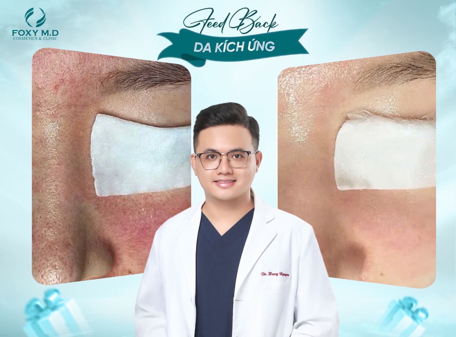 Feedback da kích ứng – Chia sẻ thật từ trải nghiệm thật